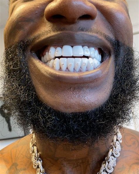 is gucci manes teeth fake|gucci mane diamond studs.